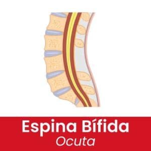 noticia_3